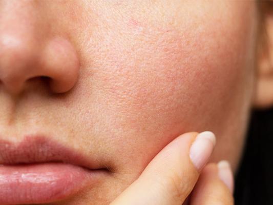 7 skincare mistakes that are making your pores look larger