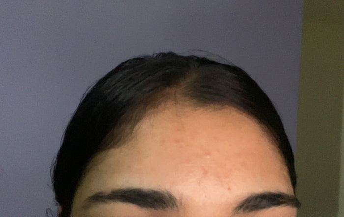 After